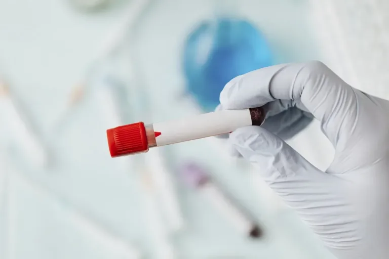 Dörtlü Test Nedir 4'lü Test Ne Zaman Yapılır