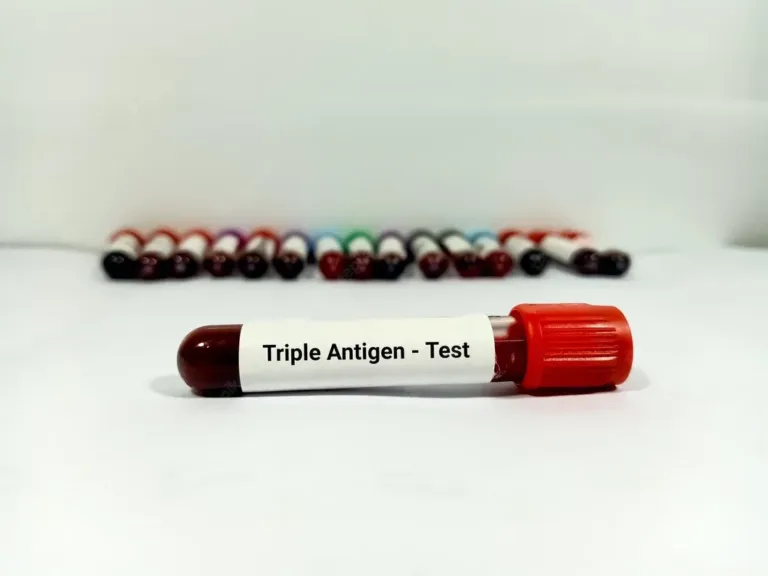 Üçlü Tarama Testi Nedir? 3'lü Test Ne Zaman Yapılır?