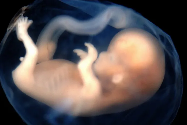 Baby Hiccups in the Womb