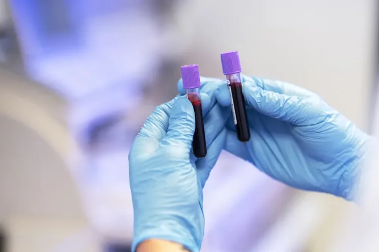 Qu&rsquo;est-ce que la bêta HCG ? À quoi ça sert ?