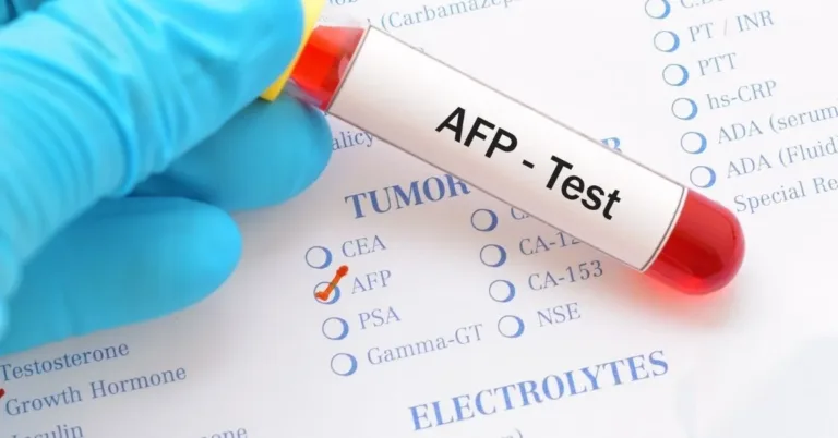 AFP Testi Nedir? Neden Yapılır?